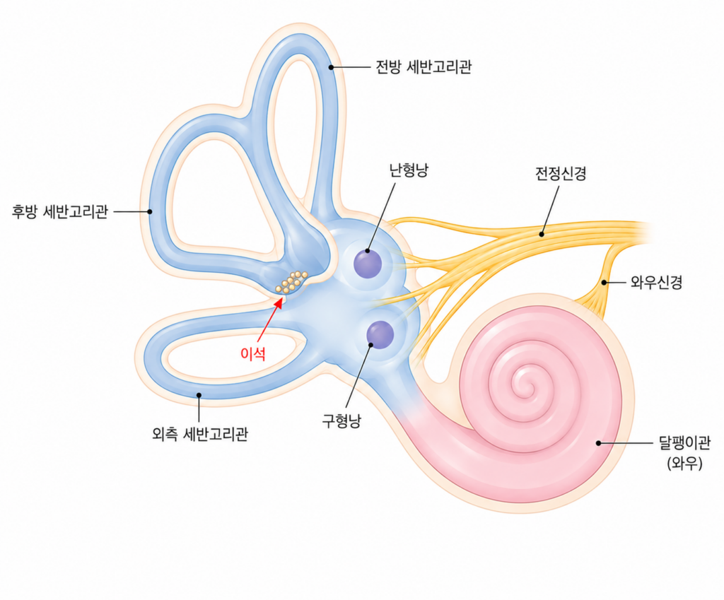 분당 서울샤인이비인후과 이석증